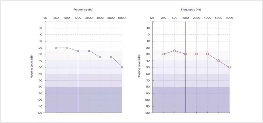 audiogram-test-results