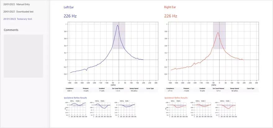 how-to-interpret-a-tympanogram